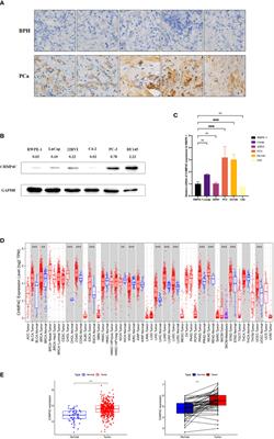 CHMP4C as a novel marker regulates prostate cancer progression through cycle pathways and contributes to immunotherapy